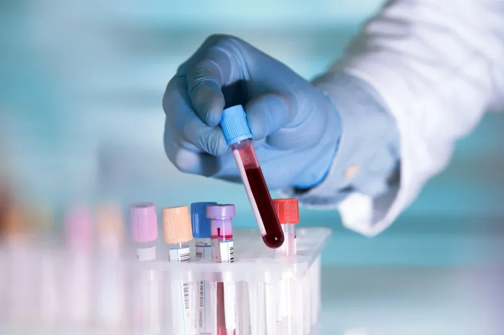 A gloved hand holding a blood sample beside other specimen tubes
